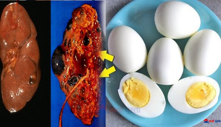kidney