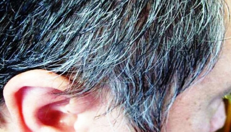 white Hair