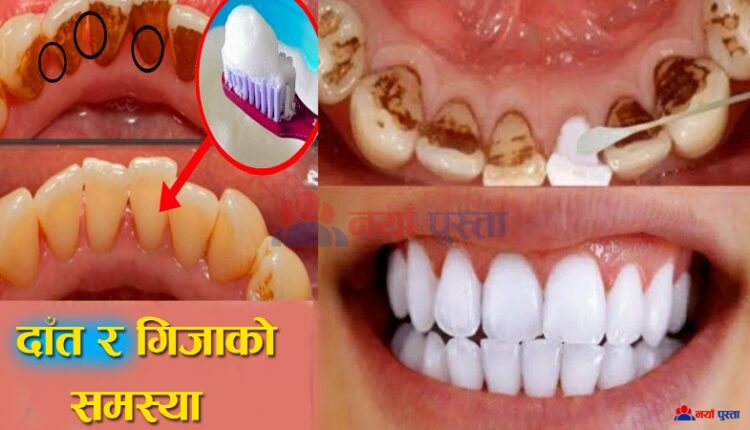 teeth