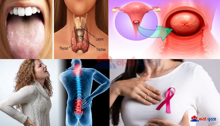 woman cancer