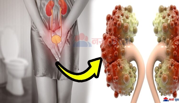 kidney